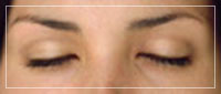 Effects of Eye Contour Care Programme