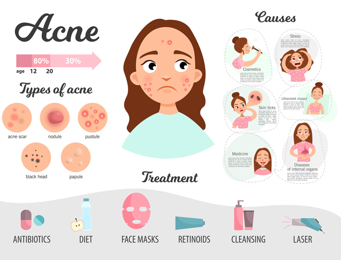 Acne treatment - Dr Thaj